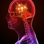 head pain
