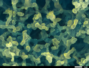 Gold particles amongst a web of filaments